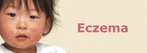 natural remedies for children with eczema children with eczema