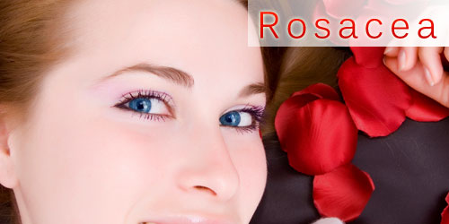 I Don’t Understand Rosacea, But It Seems Like No One Else Does Either