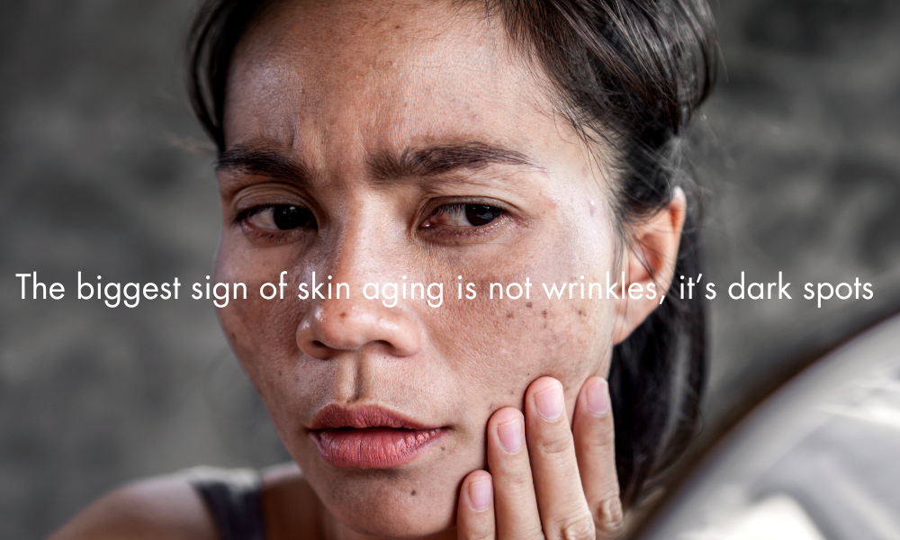 The Biggest Sign of Skin Aging is Not Wrinkles, It&rsquo;s Dark Spots